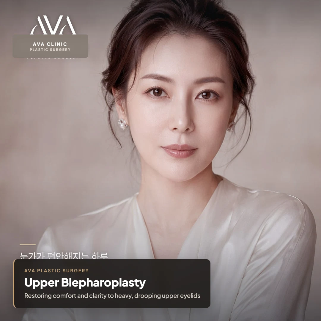 Upper Blepharoplasty — Restoring Ease to the Eyes